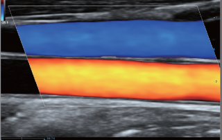 Mindray Ultrasound DC-80