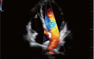 Mindray Ultrasound DC-80