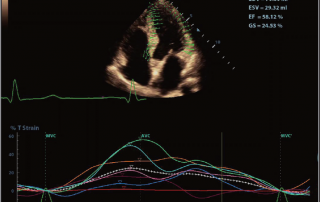 Mindray Ultrasound DC-80