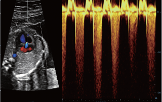 Mindray Ultrasound DC-80