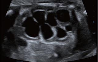 Mindray Ultrasound DC-80