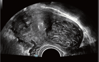 Mindray Ultrasound DC-80