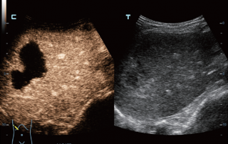 Mindray Ultrasound DC-80