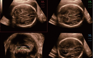 Mindray Ultrasound DC-80