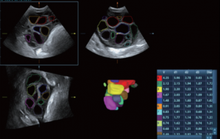 Mindray Ultrasound DC-80