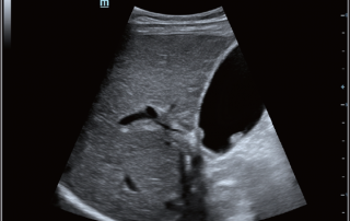 Mindray Ultrasound DC-80