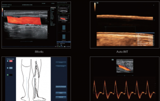 Mindray Ultrasound DC-80A