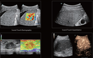 Mindray Ultrasound DC-80A