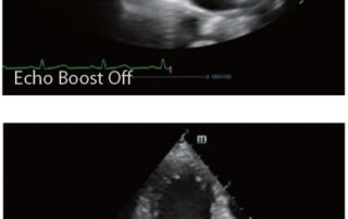 Mindray Ultrasound DC-80A