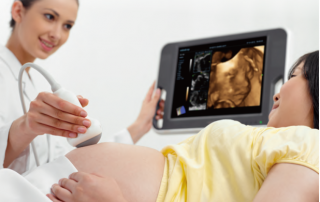 Mindray Ultrasound DC-N3 PRO