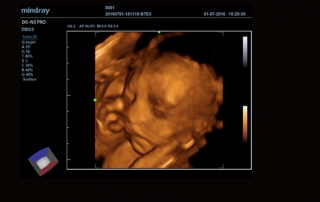 Mindray Ultrasound DC-N3 PRO