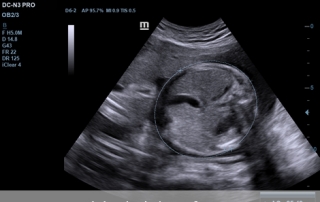 Mindray Ultrasound DC-N3 PRO