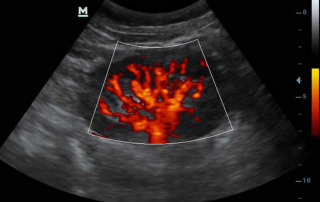 Mindray Ultrasound DP-30