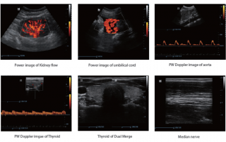 Mindray Ultrasound DP-30