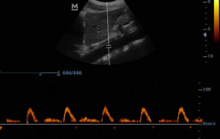 Mindray Ultrasound DP-30