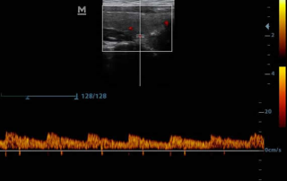 Mindray Ultrasound DP-30