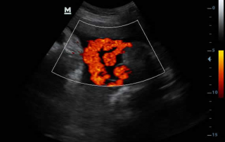Mindray Ultrasound DP-30