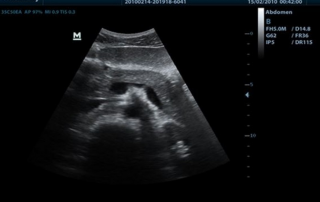 Mindray Ultrasound DP-50