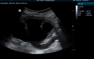Mindray Ultrasound DP-50