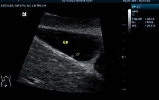 Mindray Ultrasound DP-50