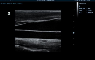 Mindray Ultrasound DP-50