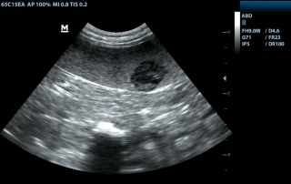 Mindray Ultrasound DP-50