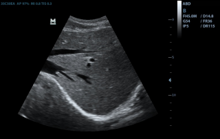 Mindray Ultrasound DP-50