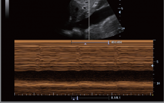 Mindray Ultrasound M6
