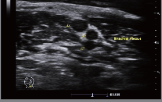 Mindray Ultrasound M6
