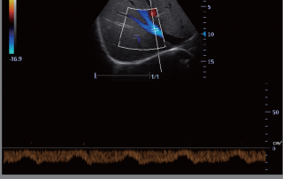 Mindray Ultrasound M6