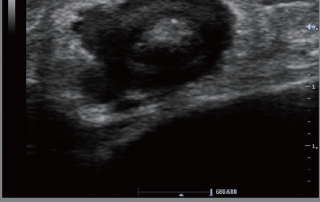 Mindray Ultrasound M6
