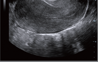 Mindray Ultrasound M6