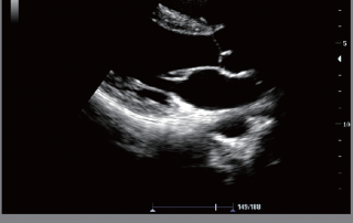 Mindray Ultrasound M6