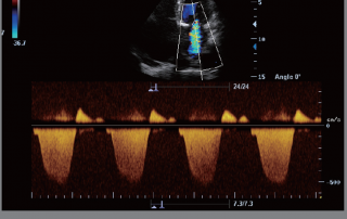 Mindray Ultrasound M6