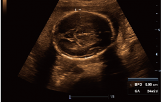 Mindray Ultrasound M6