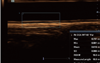 Mindray Ultrasound M6