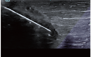 Mindray Ultrasound M6