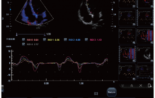 Mindray Ultrasound M6