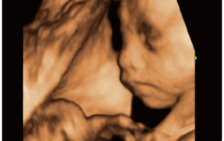 Mindray Ultrasound M6