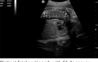 Mindray Ultrasound M7