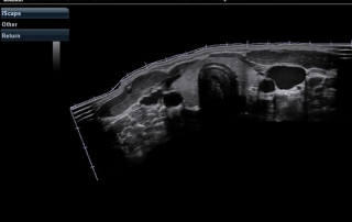 Mindray Ultrasound M7 Premium