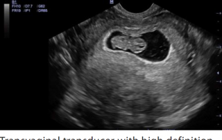 Mindray Ultrasound M7