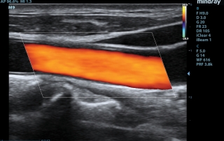 Mindray Ultrasound M9 Premium