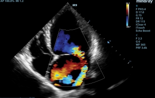 Mindray Ultrasound M9 Premium