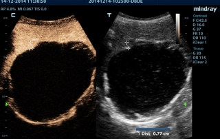 Mindray Ultrasound M9 Premium