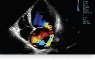Mindray Ultrasound M9 Premium