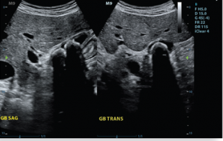Mindray Ultrasound M9 Premium