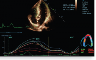 Mindray Ultrasound M9 Premium