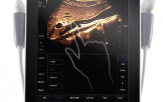 Mindray Ultrasound TE7