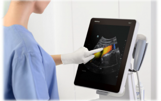 Mindray Ultrasound TE7